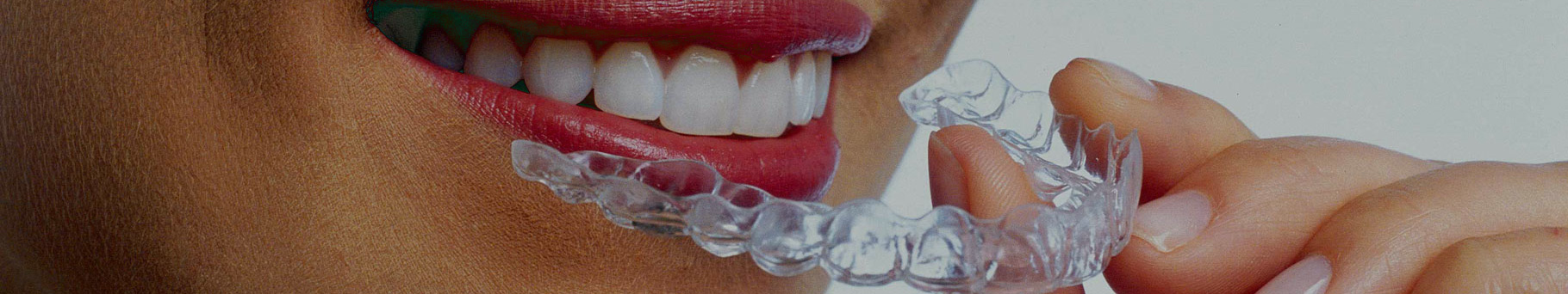 Esthetic Dentistry Tip