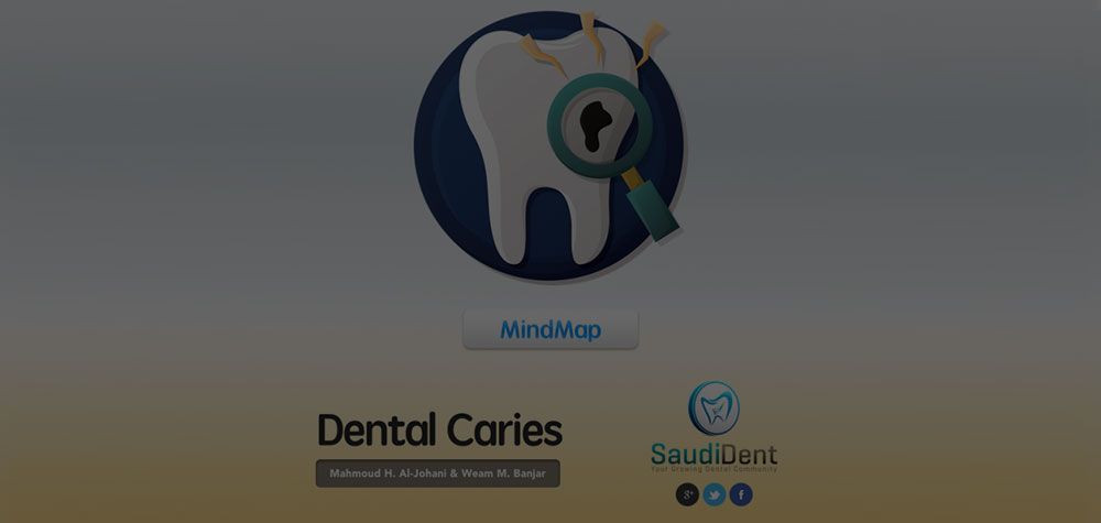 Mindmap | Dental Caries