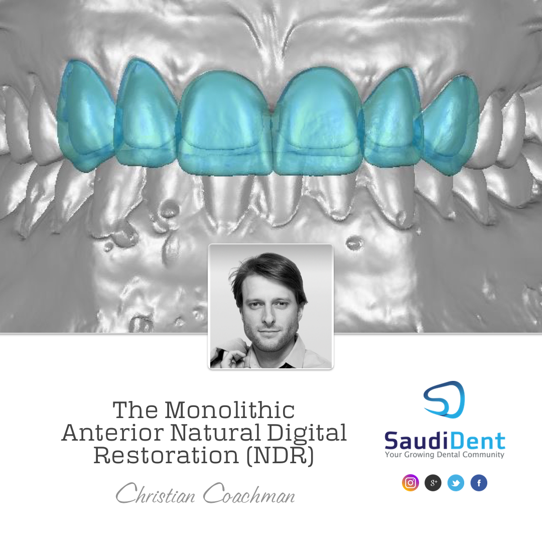 THE MONOLITHIC ANTERIOR NATURAL DIGITAL RESTORATION | Christian Coachman