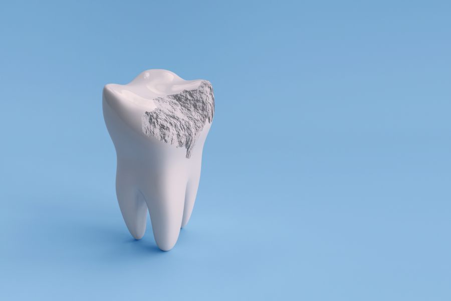 Self-healing dental composites hold great promise for the future of dentistry, potentially reducing the need for replacement of dental restorations and improving patient outcomes. As research continues, we can expect to see more advancements in this field.